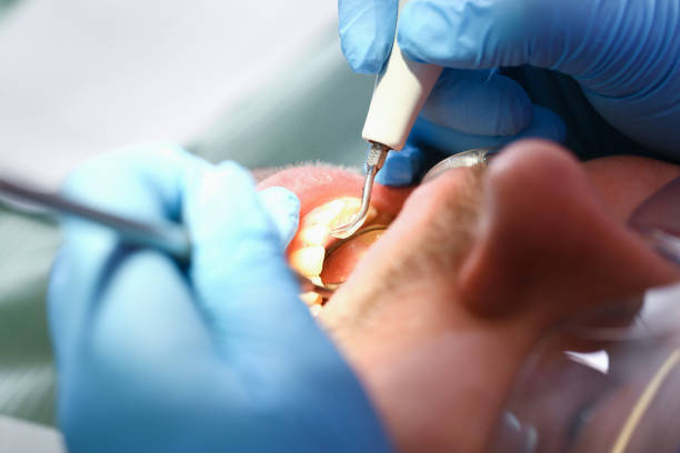Best Orthodontic Emergency Dentist in Kings Park West, VA
