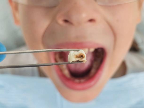 Best Urgent Dental Care for Toothache in Kings Park West, VA