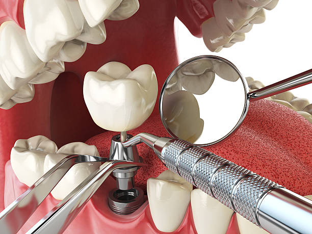 Best Mobile Emergency Dentist in Kings Park West, VA