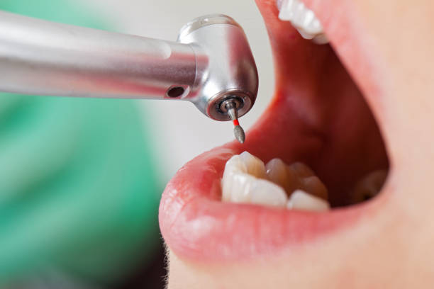 Best Emergency Dental Extractions in Kings Park West, VA